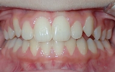 Before