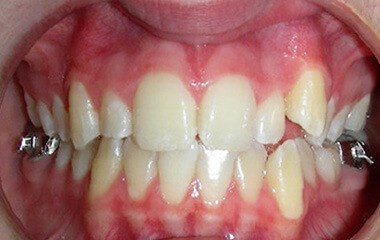 Before